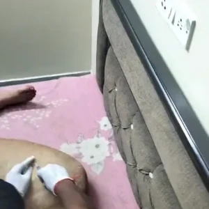 Rabies vaccination-660